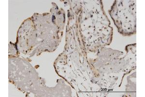 Immunostaining (ISt) image for anti-Helicase with Zinc Finger (HELZ) (AA 1-100) antibody (ABIN523312)