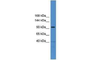 WB Suggested Anti-TRAK1  Antibody Titration: 0. (TRAK1 抗体  (Middle Region))