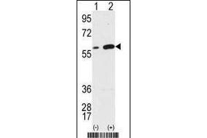 Western blot analysis of Vimentin (arrow) using Vimentin Antibody (Center) (ABIN389213 and ABIN2839368). (Vimentin 抗体  (AA 152-181))
