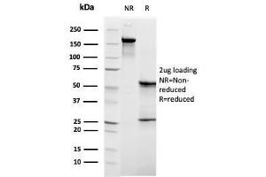 SDS-PAGE Analysis Purified C1QB Mouse Monoclonal Antibody (C1QB/2961). (C1QB 抗体  (AA 41-188))