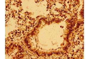 Immunohistochemistry of paraffin-embedded human lung tissue using ABIN7160437 at dilution of 1:100 (Chromosome 11open Reading Frame 9 (C11orf9) (AA 843-1004) 抗体)