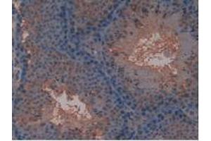 IHC-P analysis of Mouse Testis Tissue, with DAB staining. (FLT4 抗体  (AA 30-326))