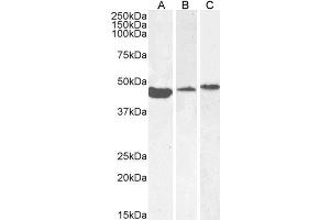 Western Blotting (WB) image for anti-Actin, alpha 2, Smooth Muscle, Aorta (ACTA2) (N-Term) antibody (ABIN185271)