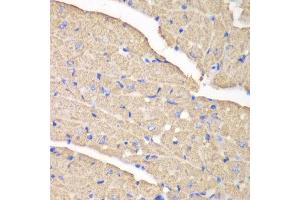 Immunohistochemistry (IHC) image for anti-Voltage-Dependent Anion Channel 1 (VDAC1) (AA 1-283) antibody (ABIN6213993) (VDAC1 抗体  (AA 1-283))