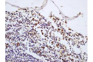Formalin-fixed and paraffin embedded mouse spleen labeled with Rabbit Anti-IRAK1 (Thr387) Polyclonal Antibody, Unconjugated  at 1:200 followed by conjugation to the secondary antibody and DAB staining (IRAK1 抗体  (pThr387))