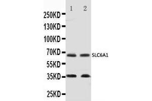 Anti-GABA Transporter 1/GAT 1 antibody, Western blotting Lane 1: Rat Brain Tissue Lysate Lane 2: Mouse Brain Tissue Lysate (SLC6A1 抗体  (C-Term))