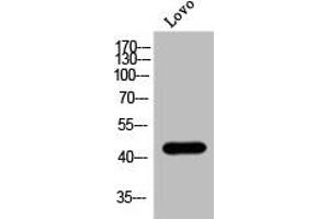Western Blot analysis of Lovo cells using Phospho-MOR-1 (S375) Polyclonal Antibody (Mu Opioid Receptor 1 抗体  (pSer375))