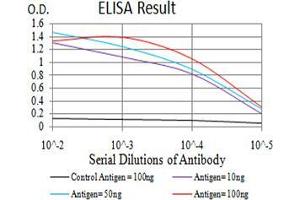 Black line: Control Antigen (100 ng);Purple line: Antigen (10ng); Blue line: Antigen (50 ng); Red line:Antigen (100 ng) (CTNNA1 抗体  (AA 371-574))