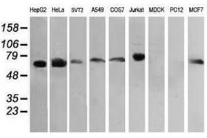 Image no. 7 for anti-RIO Kinase 2 (RIOK2) (AA 277-552) antibody (ABIN1491305)