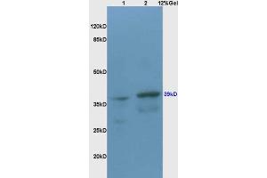 Lane 1: rat brain lysates Lane 2: mouse heart lysates probed with Anti CX3CR1 Polyclonal Antibody, Unconjugated (ABIN733583) at 1:200 in 4 °C. (CX3CR1 抗体  (AA 151-250))