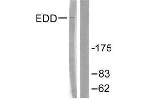 Western blot analysis of extracts from A549 cells, using EDD antibody. (UBR5 抗体)