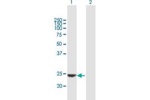 Western Blot analysis of KLK14 expression in transfected 293T cell line by KLK14 MaxPab polyclonal antibody. (Kallikrein 14 抗体  (AA 1-251))