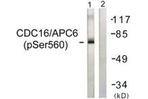 Western blot analysis of extracts from HuvEc cells, using CDC16/APC6 (Phospho-Ser560) Antibody. (CDC16 抗体  (pSer560))