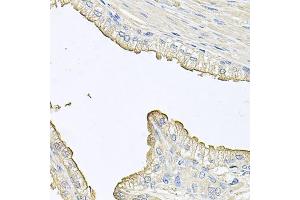 Immunohistochemistry of paraffin-embedded human prostate using FABP12 antibody. (FABP12 抗体)