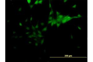 Immunofluorescence of monoclonal antibody to NR2E1 on NIH/3T3 cell.