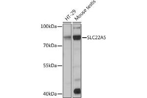 Western blot analysis of extracts of various cell lines, using SLC22 Rabbit pAb (ABIN3022378, ABIN3022379, ABIN3022380, ABIN1513530 and ABIN6218770) at 1:1000 dilution. (SLC22A5 抗体  (AA 1-180))