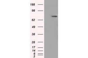 HEK293T cells were transfected with the pCMV6-ENTRY control (Left lane) or pCMV6-ENTRY BTK (Right lane) cDNA for 48 hrs and lysed. (BTK 抗体)