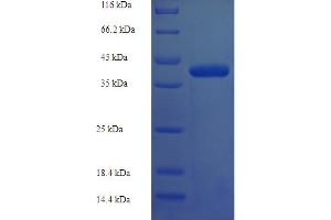 SDS-PAGE (SDS) image for Deoxynucleotidyltransferase, Terminal, Interacting Protein 1 (DNTTIP1) (AA 1-329), (full length) protein (His tag) (ABIN5709415)