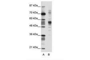 Image no. 1 for anti-Coronin, Actin Binding Protein, 1A (CORO1A) (C-Term) antibody (ABIN202576)