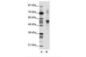 Image no. 1 for anti-Coronin, Actin Binding Protein, 1A (CORO1A) (C-Term) antibody (ABIN202576) (Coronin 1a 抗体  (C-Term))