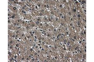 Immunohistochemical staining of paraffin-embedded liver tissue using anti-AKR1A1mouse monoclonal antibody. (AKR1A1 抗体)