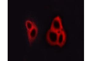 ABIN6267615 staining A549 cells by ICC/IF. (GRIN1/NMDAR1 抗体  (pSer890))