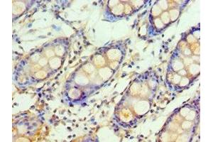 Immunohistochemistry of paraffin-embedded human colon tissue using ABIN7154111 at dilution of 1:100 (GSTM4 抗体  (AA 1-218))