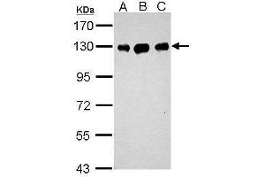 WB Image Sample (30 ug of whole cell lysate) A: Neuro2A B: GL261 C: C8D30 7. (DDB1 抗体  (C-Term))