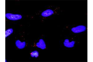 Proximity Ligation Analysis of protein-protein interactions between PLCG2 and ERBB2. (ErbB2/Her2 抗体  (AA 22-121))