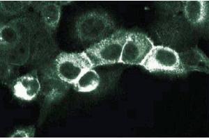 Immunofluorescence staining of A431 cells (Human epithelial carcinoma, ATCC CRL-1555). (ErbB2/Her2 抗体  (AA 182-373))