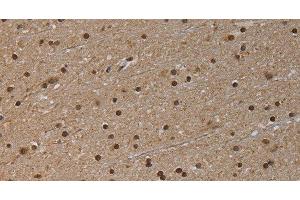 Immunohistochemistry of paraffin-embedded Human brain tissue using NLRP6 Polyclonal Antibody at dilution 1:50 (NLRP6 抗体)