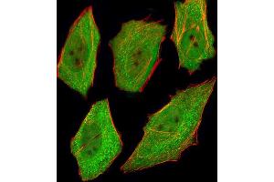 Fluorescent image of  cells stained with VCP Antibody (ABIN1944899 and ABIN2838502). (VCP 抗体  (AA 1-225))