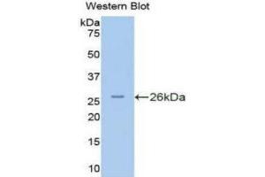 Western Blotting (WB) image for anti-Protein Kinase N2 (PKN2) (AA 282-487) antibody (ABIN1175312) (PKN2 抗体  (AA 282-487))