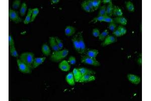 Immunofluorescent analysis of HepG2 cells using ABIN7165354 at dilution of 1:100 and Alexa Fluor 488-congugated AffiniPure Goat Anti-Rabbit IgG(H+L) (FAM111A 抗体  (AA 26-179))