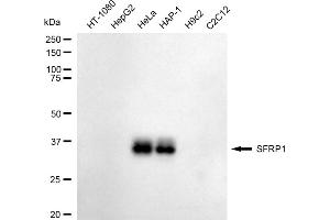 anti-Secreted Frizzled-Related Protein 1 (SFRP1) antibody