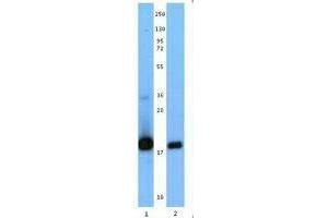Western Blotting (WB) image for anti-Interleukin 21 (IL21) antibody (ABIN2666226) (IL-21 抗体)