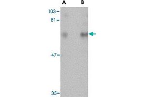 Western blot analysis of CPEB1 in rat brain tissue lysate with CPEB1 polyclonal antibody  at (A) 1 and (B) 2 ug/mL . (CPEB1 抗体  (N-Term))