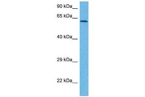 Western Blotting (WB) image for anti-NADPH Oxidase 1 (NOX1) (C-Term) antibody (ABIN2782754)