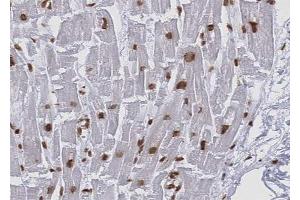 ABIN6268814 at 1/100 staining human Heart muscle tissue sections by IHC-P. (KEAP1 抗体)