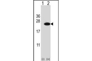 Western blot analysis of CIRBP (arrow) using rabbit polyclonal CIRBP Antibody (C-term) (ABIN653083 and ABIN2842680). (CIRBP 抗体  (C-Term))