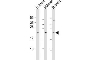 All lanes : Anti-FGF12 Antibody (Center) at 1:1000 dilution Lane 1: human brain lysate Lane 2: mouse brain lysate Lane 3: rat brain lysate Lysates/proteins at 20 μg per lane. (FGF12 抗体  (AA 159-191))