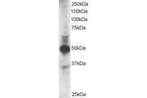 Western Blotting (WB) image for anti-GATA Binding Protein 3 (GATA3) (N-Term) antibody (ABIN2465221) (GATA3 抗体  (N-Term))