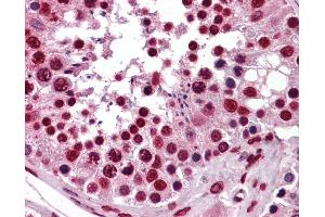 Immunohistochemistry (IHC) image for anti-KH-Type Splicing Regulatory Protein (KHSRP) (AA 151-240) antibody (ABIN574396)