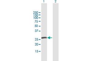 Western Blot analysis of SPC25 expression in transfected 293T cell line by SPC25 MaxPab polyclonal antibody. (SPC25 抗体  (AA 1-224))