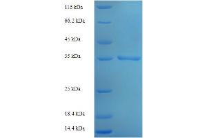 SDS-PAGE (SDS) image for Malignant T Cell Amplified Sequence 1 (MCTS1) (AA 1-181), (full length) protein (His-SUMO Tag) (ABIN5711965)