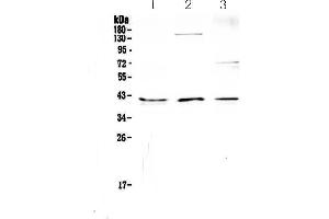 Western blot analysis of CD47 using anti-CD47 antibody . (CD47 抗体)