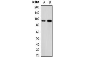 Western blot analysis of Calpain 3 expression in MCF7 (A), PC12 (B) whole cell lysates. (Calpain 3 抗体  (Center))
