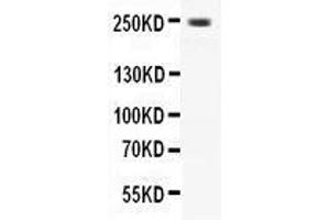 Western Blotting (WB) image for anti-Calcium Channel, Voltage-Dependent, L Type, alpha 1D Subunit (CACNA1D) (AA 2146-2161), (C-Term) antibody (ABIN3042544) (CACNA1D 抗体  (C-Term))