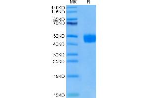 Cynomolgus BST1 on Tris-Bis PAGE under reduced condition. (BST1 Protein (AA 26-289) (His tag))