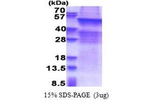 SDS-PAGE (SDS) image for UDP Glycosyltransferase 8 (UGT8) (AA 21-541) protein (His tag) (ABIN5853352) (UGT8 Protein (AA 21-541) (His tag))